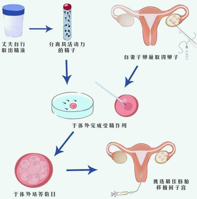 广州试管代怀生子